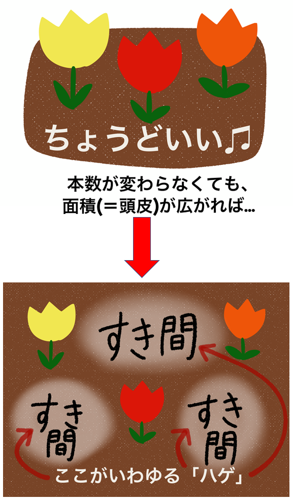 髪の毛の本数が変わらなくても頭皮面積が広くなればハゲて見える