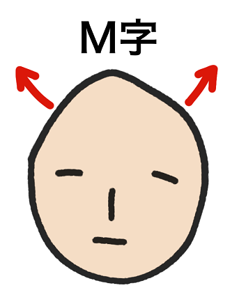 とんがり頭はM字ハゲになりやすい