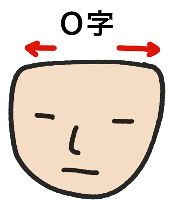 ハチ張り頭はO字ハゲになりやすい