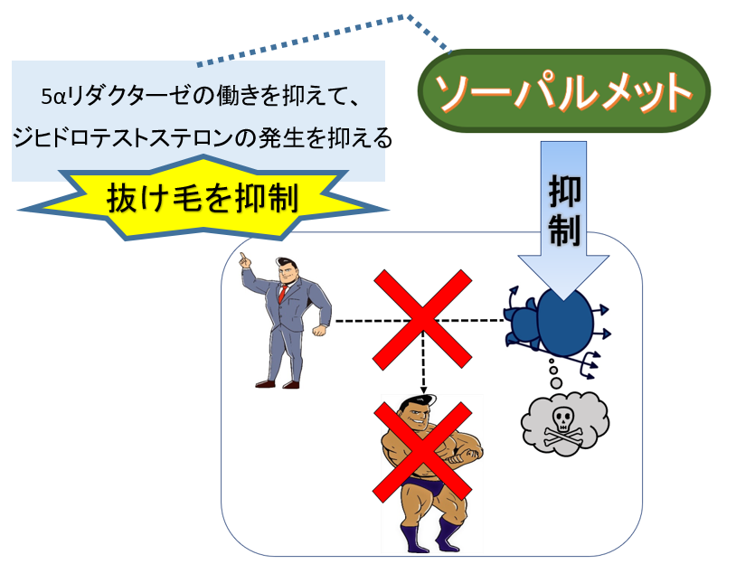 ソーパルメットに期待される育毛効果