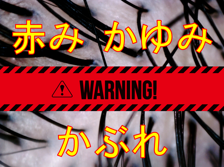 ミノキシジルの副作用